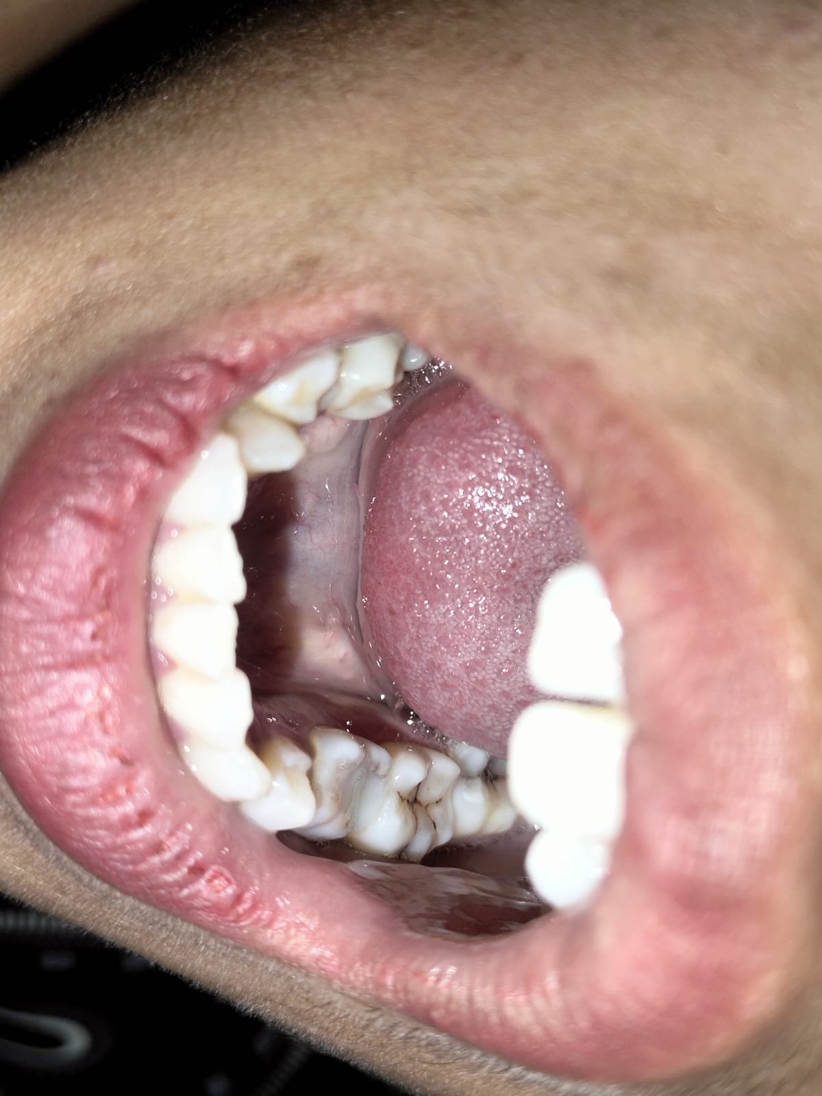 Emergency Dental Care