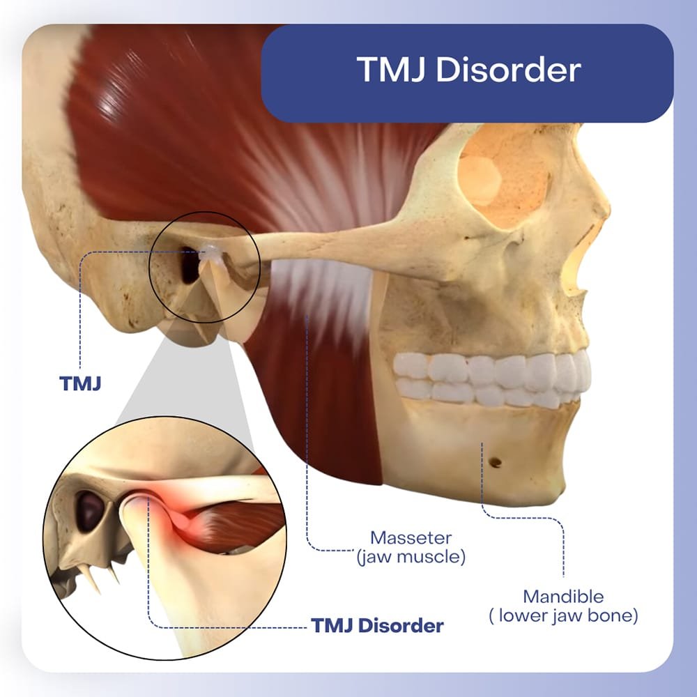 TMJ Treatment