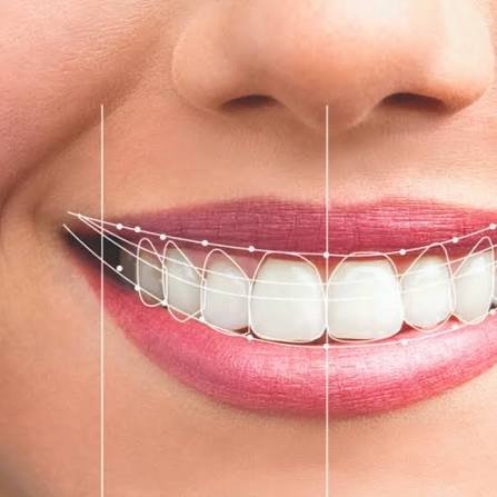 Digital Smile Designing