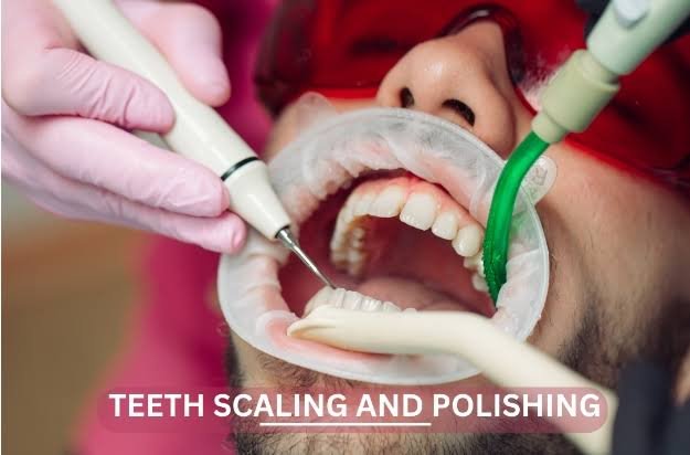 Scaling and Polishing