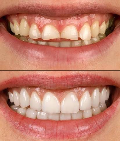 Smile Redesign for Your Comfort Mobile